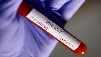 Delhi records 517 fresh COVID-19 cases, positivity rate 4.21%