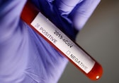 Delhi sees 2,726 new coronavirus cases, six fatalities