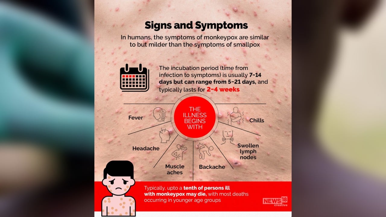 In humans, the symptoms of monkeypox are similar to but milder than the symptoms of smallpox. (Image: News18 Creative)