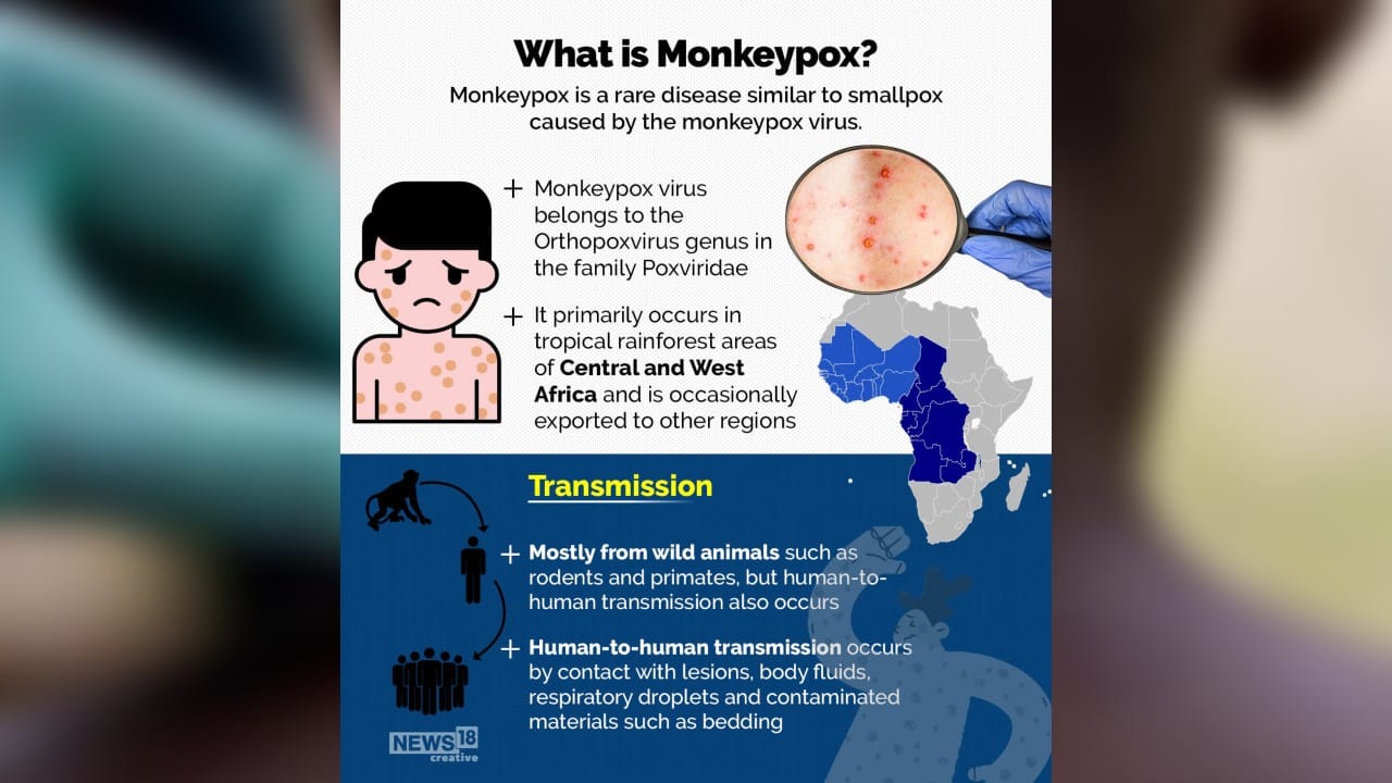 Monkeypox: What You Need to Know