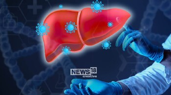 India accounts for second highest number of cases in hepatitis B & C after China, says WHO report