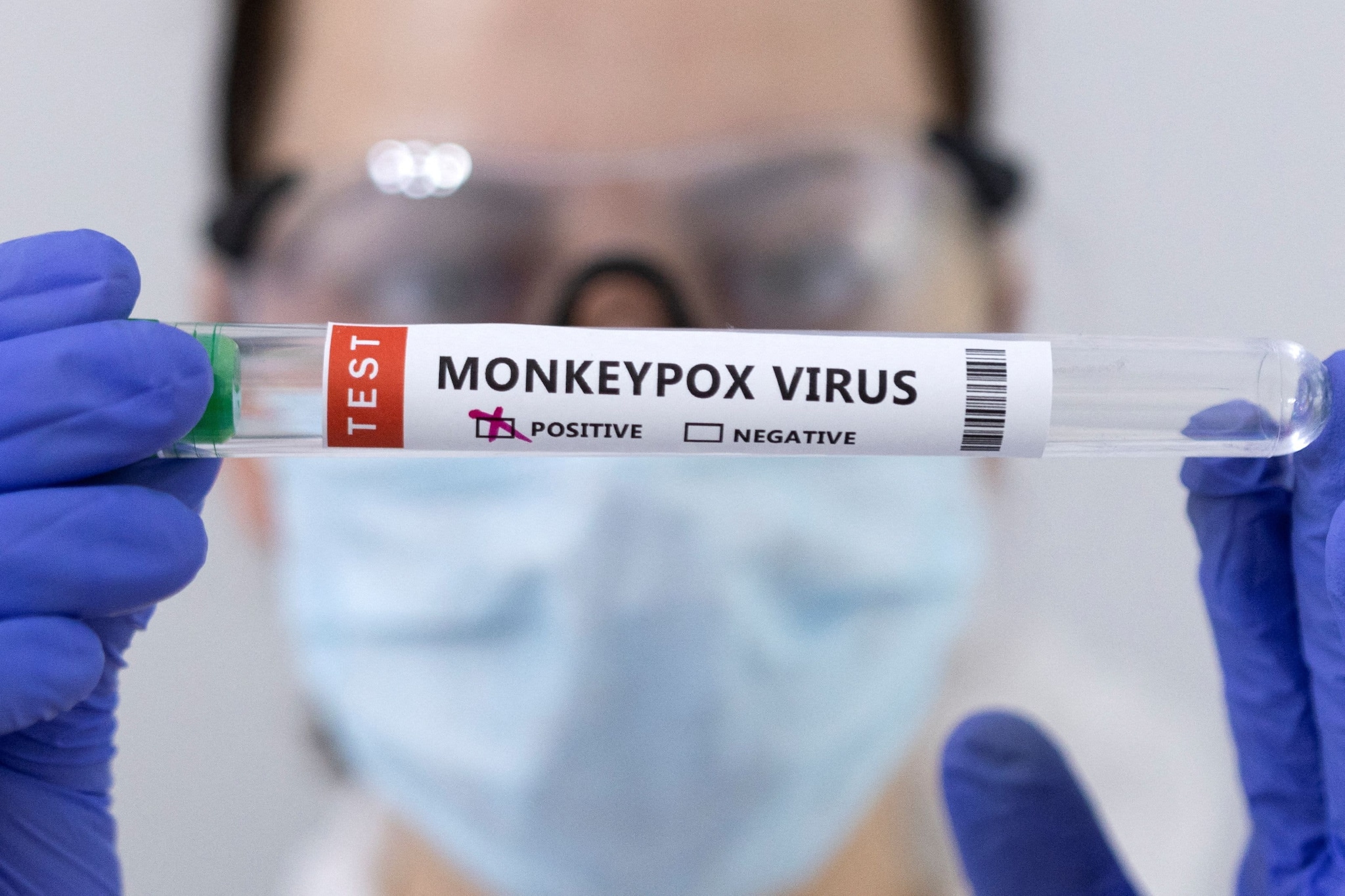 Monkeypox outbreak: What we know so far Monkeypox outbreak: What we know so far