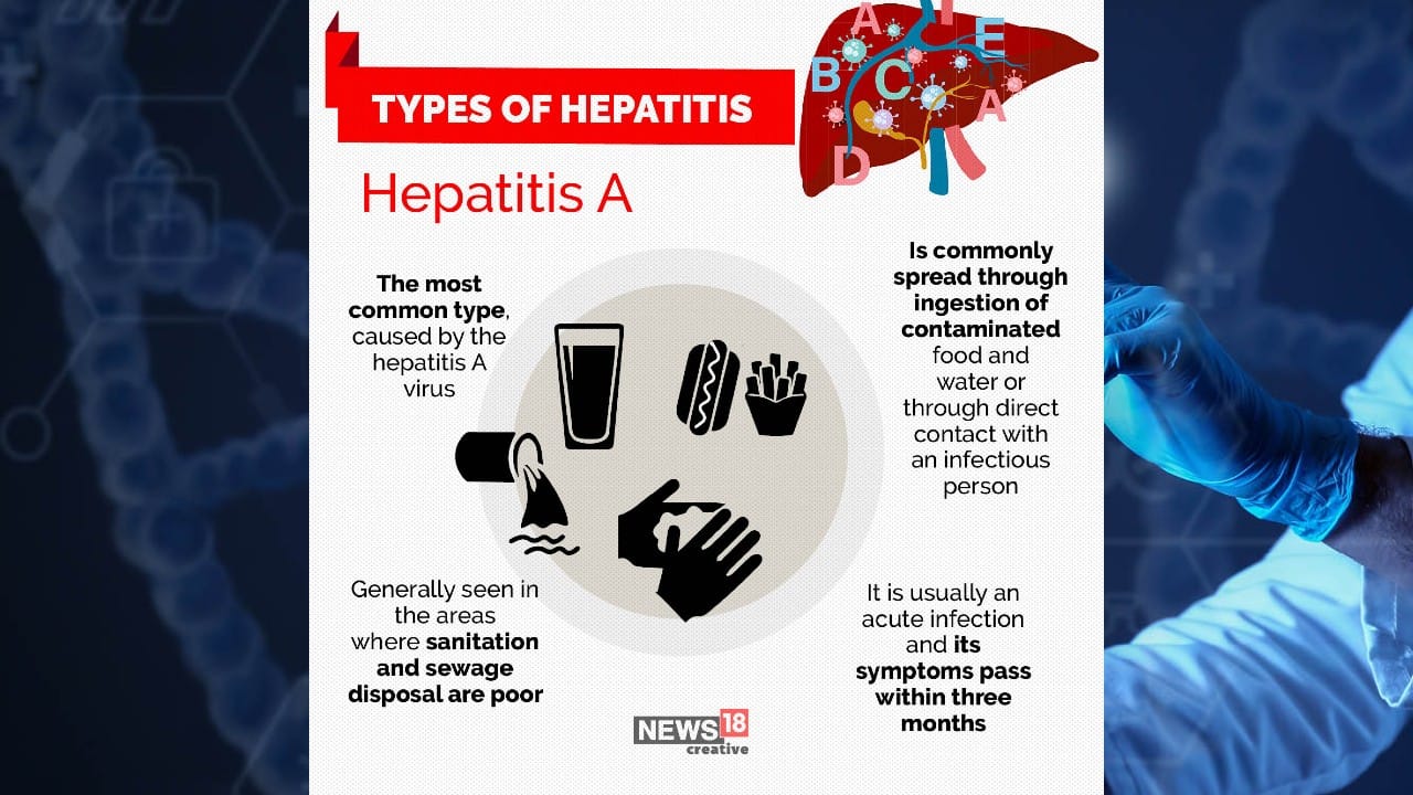 The most common type, Hepatitis A, is commonly spread through ingestion of contaminated food and water or through direct contact with an infectious person. (Image: News18 Creative)