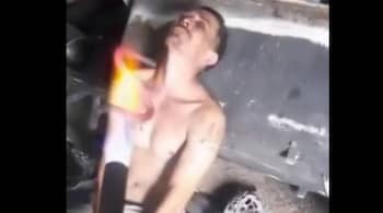 Russian man brands himself with Z symbol (Image credit: @nexta_tv/Twitter)