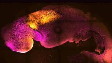 Don’t squander a key advance in fertility research Don’t squander a key advance in fertility research