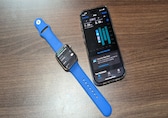 57-year-old woman ignored her headaches until Apple Watch exposed the real cause