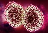 Kingdom of the Sick: Breast cancer and me