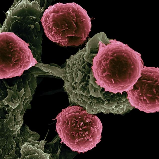 India gets first dedicated precision oncology centre India gets first dedicated precision oncology centre