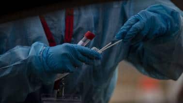 As COVID19 cases mount, time to avoid past mistakes of complacency As COVID19 cases mount, time to avoid past mistakes of complacency