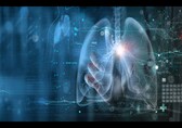 Can Artificial Intelligence predict lung cancer in non-smokers?
