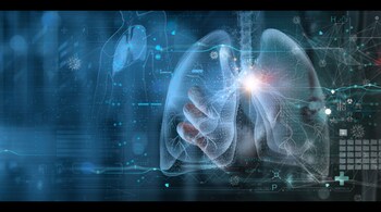 AI will be able to detect lung cancer in non-smokers in the future. (Photo: Getty Images)