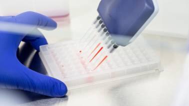 Breast cancer vaccine trials have started and show promise