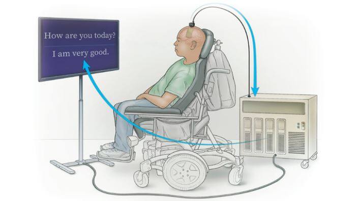 Listening to the brain