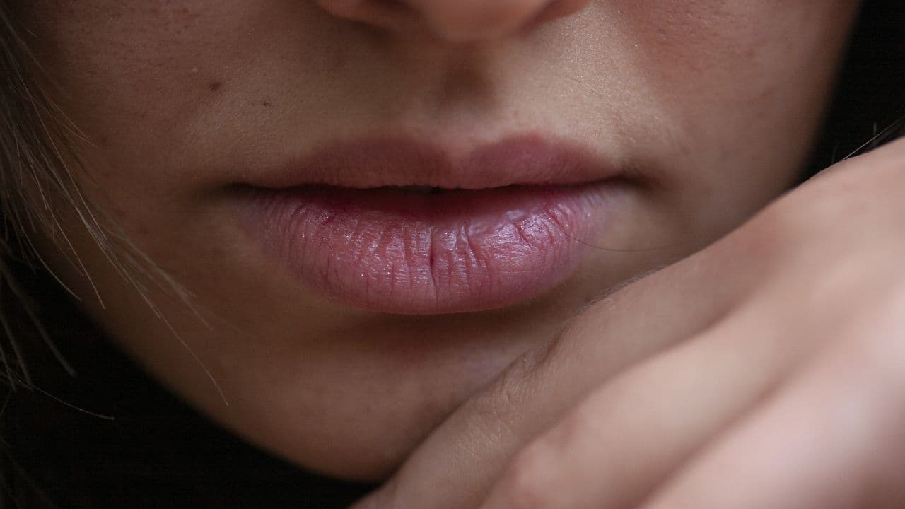 Are your lips turning dark? Try these expert-approved home remedies, tips and tricks