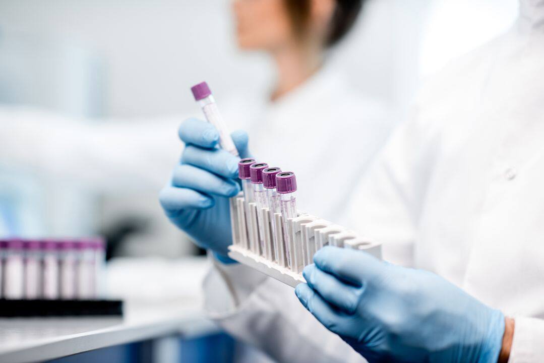 RPG Life Sciences: The pharmaceutical products maker has registered a 37.6% year-on-year growth in profit at Rs 10.35 crore for quarter ended March FY23, and revenue for the quarter increased by 14.1% YoY to Rs 118.5 crore. EBITDA increased by 17.8% YoY to Rs 15.91 crore with margin expansion of 41 bps at 13.42% for quarter ended March FY23. The company announced equity dividend of Rs 12 per share for FY23.