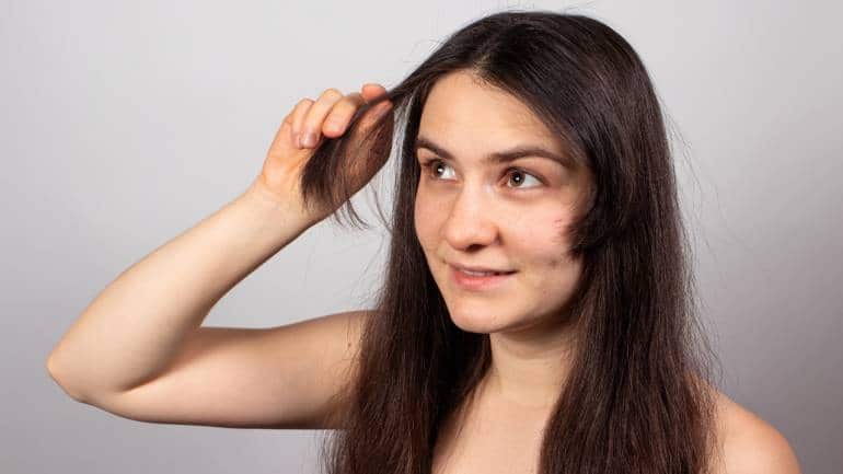 7 Amazing Winter Hair Care Home Remedies  Fashion