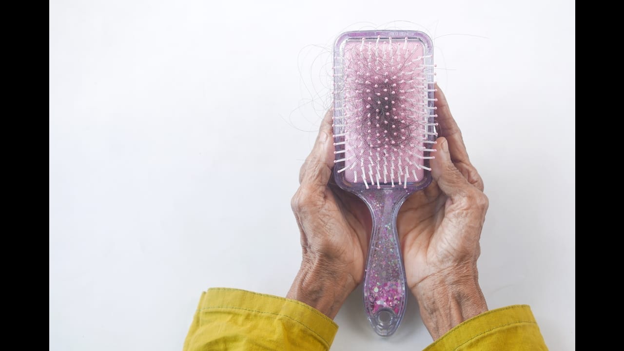 Hair loss: When losing your hair makes you lose your mind