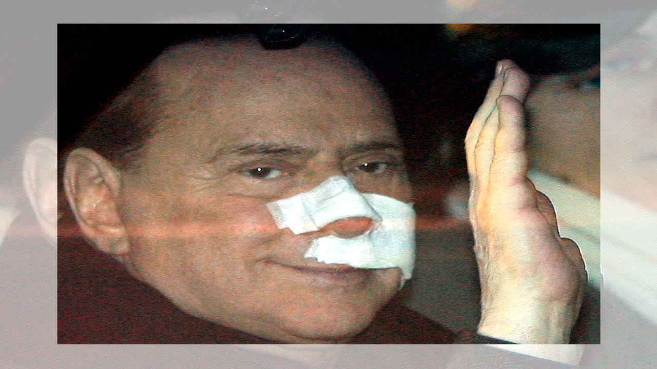 Health concerns dogged him over the years. He underwent surgery for prostate cancer in 1997. In November 2006, he fainted during a speech, and the next month flew to the U.S., where he received a pacemaker at the Cleveland Clinic. He underwent more heart surgery in 2016. (Source: AP)