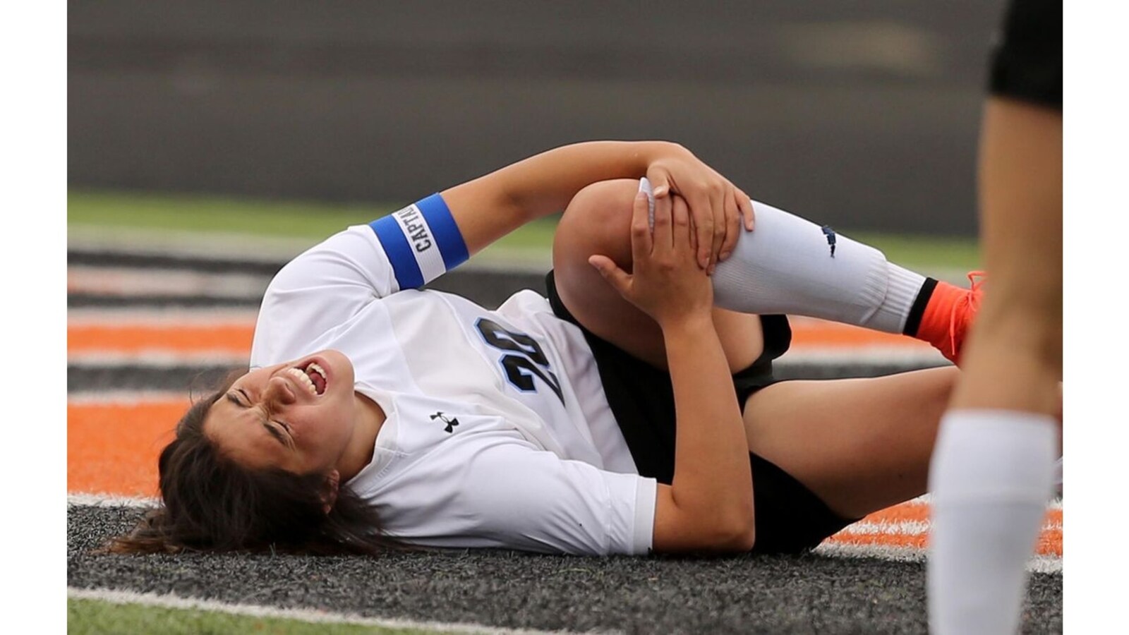 Are ACL Tears Really More Common in Women? > News > Yale Medicine