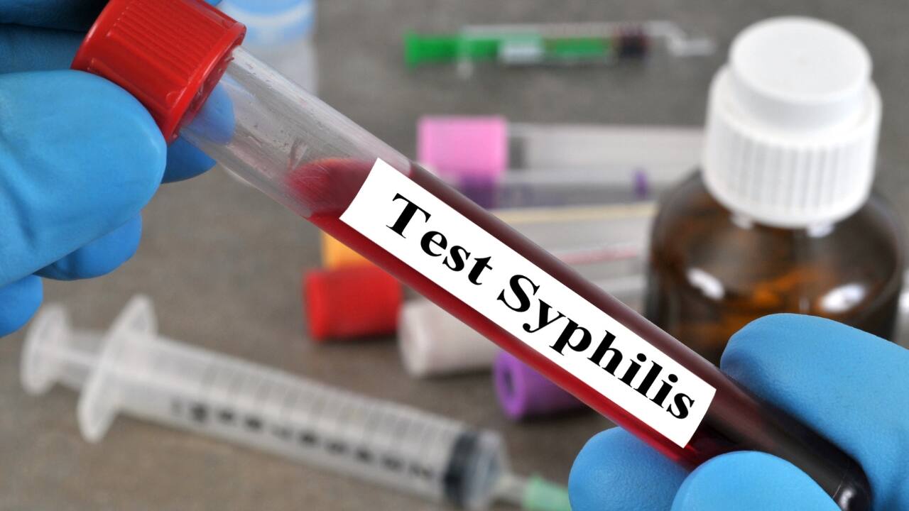 Syphilis: Everything you need to know about the danger behind painless sores on genitals
