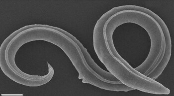The worm spent thousands of years in a type of dormancy called cryptobiosis which can last almost indefinitely. (Image credit: Plosgenetics)