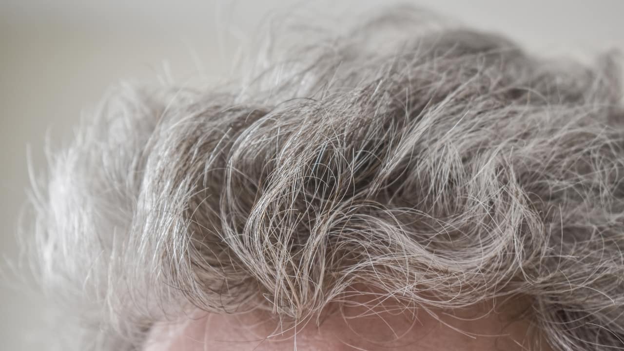Premature greying: What's turning your hair grey so soon?