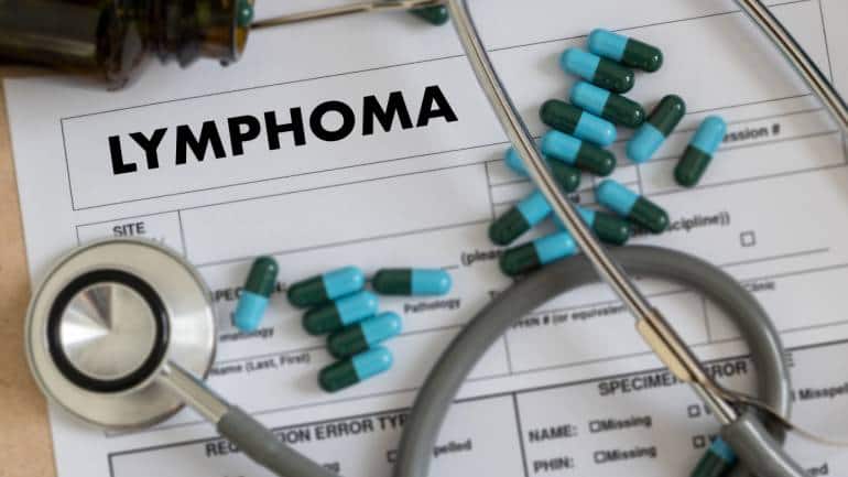 Causes Symptoms And Cure For Lymphoma 770x433 