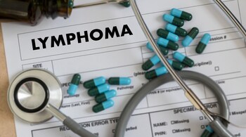 Causes, symptoms and cure for lymphoma (Image: Canva)