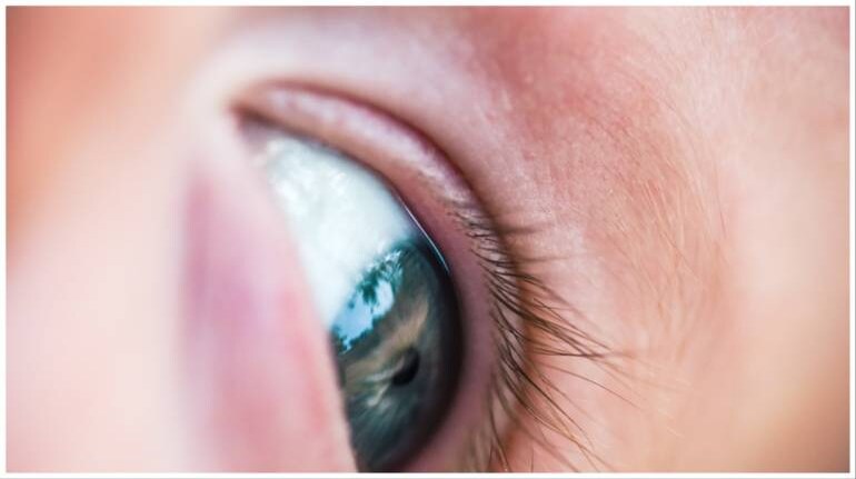 baby-s-brown-eyes-dramatically-turn-blue-after-covid-treatment-study