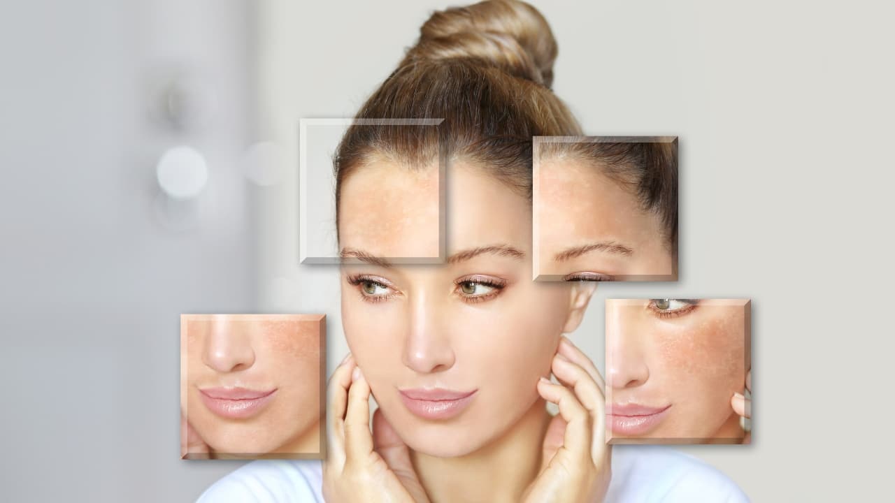 Is your skin excessively dry, rough, scaly? Can't stop itching? It could be xeroderma