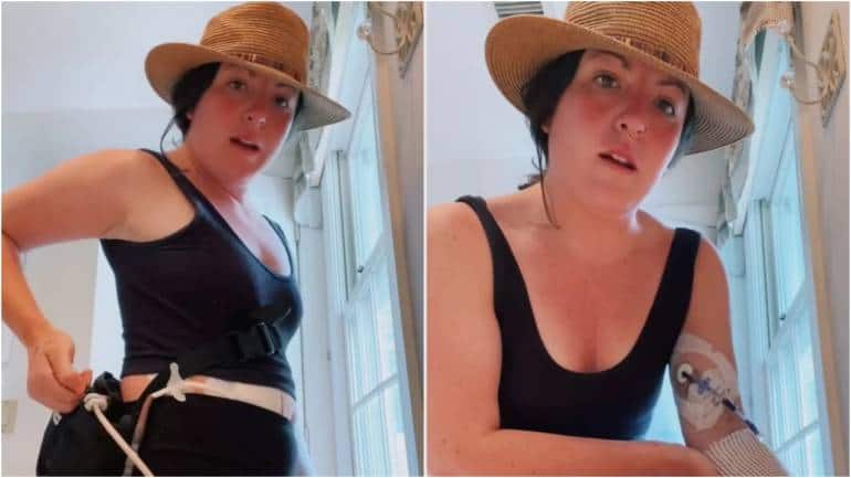 Woman, 30, says she has no pulse due to rare heart condition. 'I run on batteries' - Vimarsana News