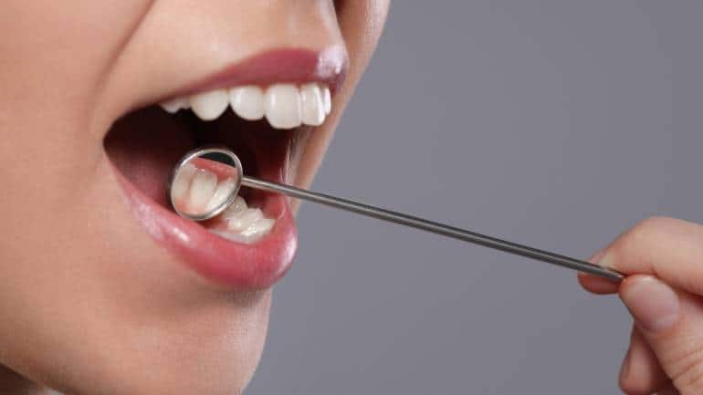 Oral cancer: Causes, symptoms and prevention methods to stay away from this danger - Vimarsana News