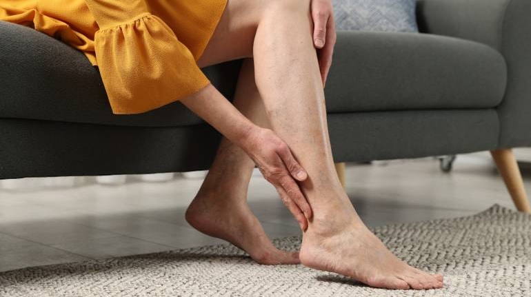 Deep Vein Thrombosis (DVT): Causes, symptoms and how to prevent