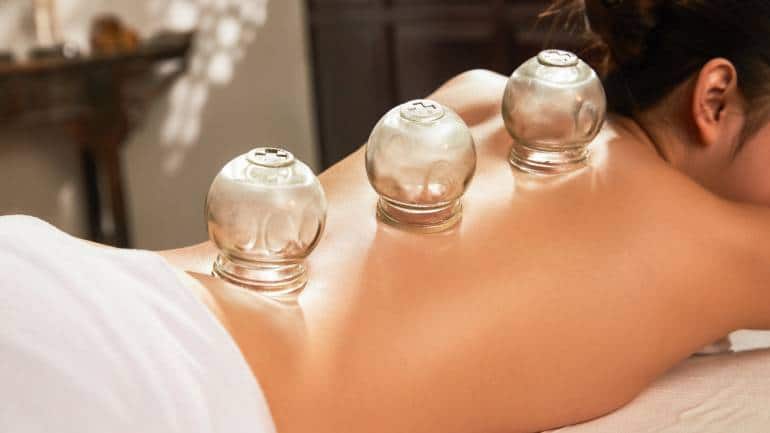 What is cupping therapy? Here's everything you need to know about this ancient healing practice - Vimarsana News