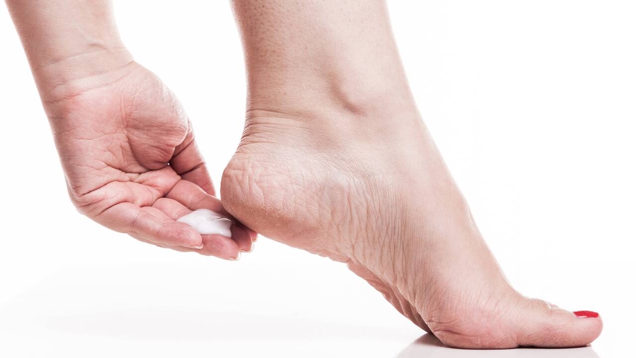 Top 12 home remedies for cracked heels | SingleCare