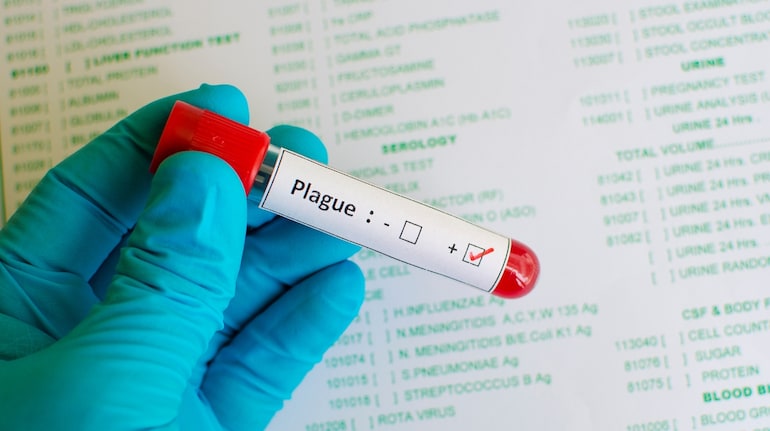 A death, a lab accident and a possible plague link: Why Russia’s ...