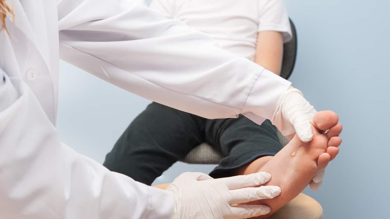 Warts: How to identify, causes, and treatment options for these small, blister-like growths