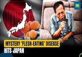 Japan’s Mystery Flesh-Eating Disease: Is it the return of a Covid-like era for the country?