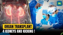 AIIMS-Delhi performs first dual kidney transplant, recipient now has 4 kidneys
