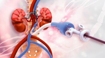 High cholesterol can increase the risk of heart disease and stroke, making it crucial to keep track of your numbers regularly. (Image: Canva)