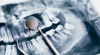 The device offers quick and painless screening with 90 percent accuracy in clinical settings.