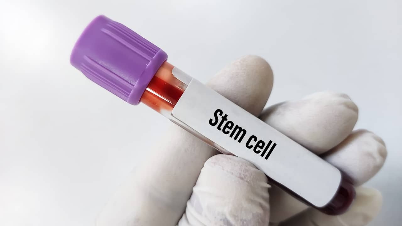 Cancer treatment: What is stem cell therapy, and how does it work?