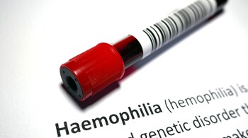 Hemophilia: People with hemophilia live with the constant threat of injury. This can make everyday activities, like walking, exercising, or playing, a source of stress (Image: Canva)