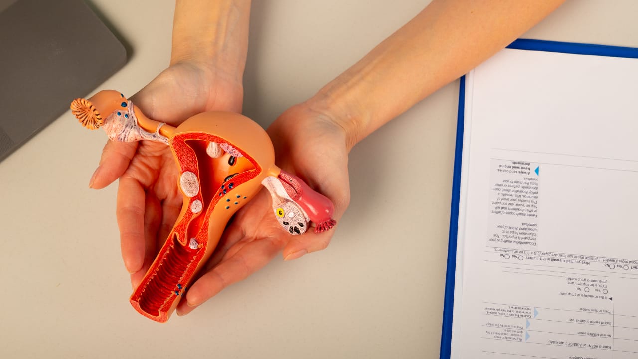 World Ovarian Cancer Day: 6-crucial factors every patient must follow