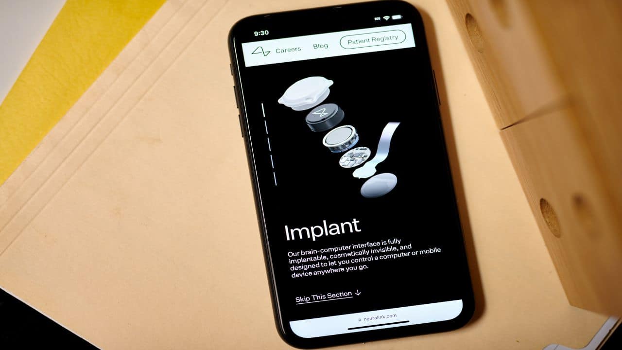 Neuralink says implant had issues after first human surgery
