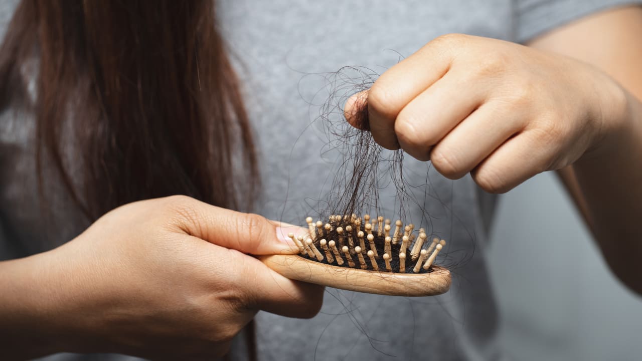 Home remedies for dry, brittle hair, dandruff Add these 7 Omega3rich