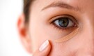 Under-eye care: 8 things you must never apply in this sensitive area