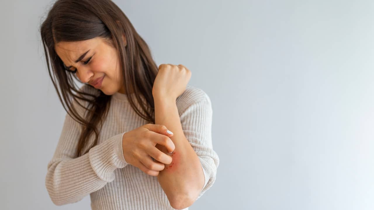 Home remedies for eczema: Use coconut oil, aloe vera gel, honey for this chronic skin condition