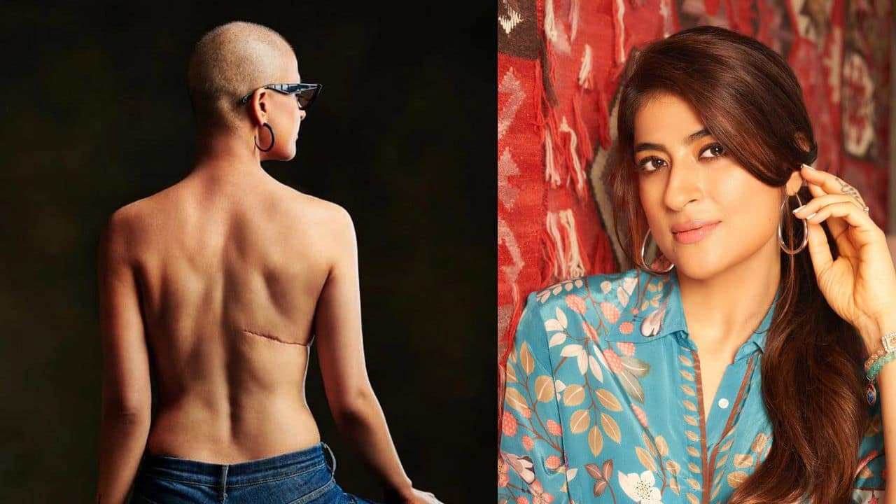 Tahira Kashyap's breast cancer relapses after 7 years, writes: ‘ironically or not, today is World Health Day'
