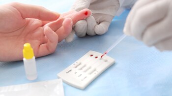Myths and reality of HIV infections: Modern HIV tests are highly accurate, and false positives are very rare. (Image: Canva)